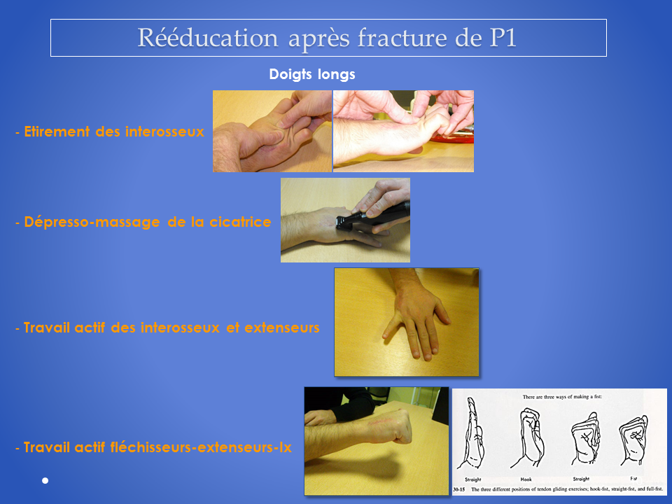 kinesitherapeute-main-grenoble-reeducation-10