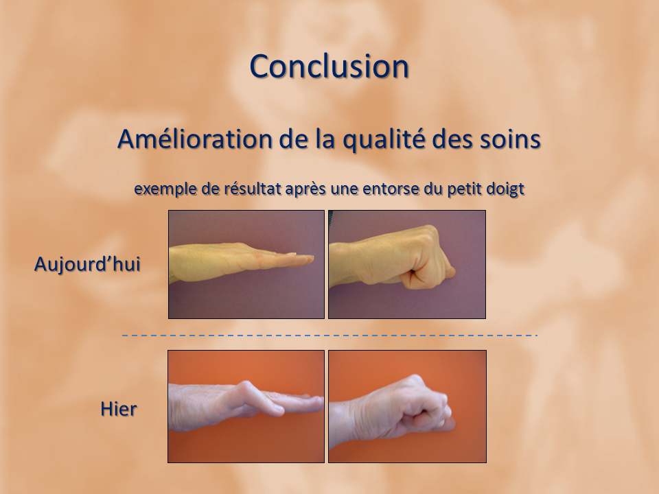 kinesitherapeute-main-grenoble-reeducation-fracture-gerlac-18